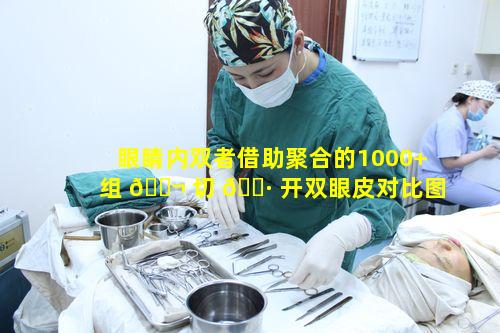 眼睛内双者借助聚合的1000+组 🐬 切 🌷 开双眼皮对比图能得到怎样的启示